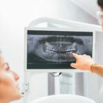 dental xray