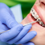 orthodontics