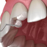 restorative dentistry